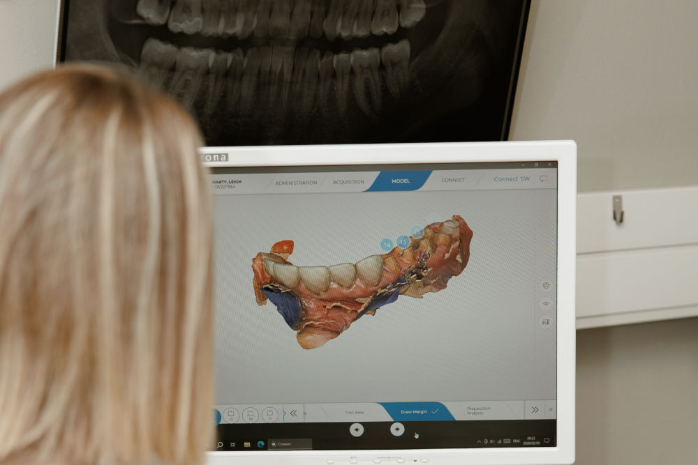 Dental implants at Dr Anrinette van Wyk's practice